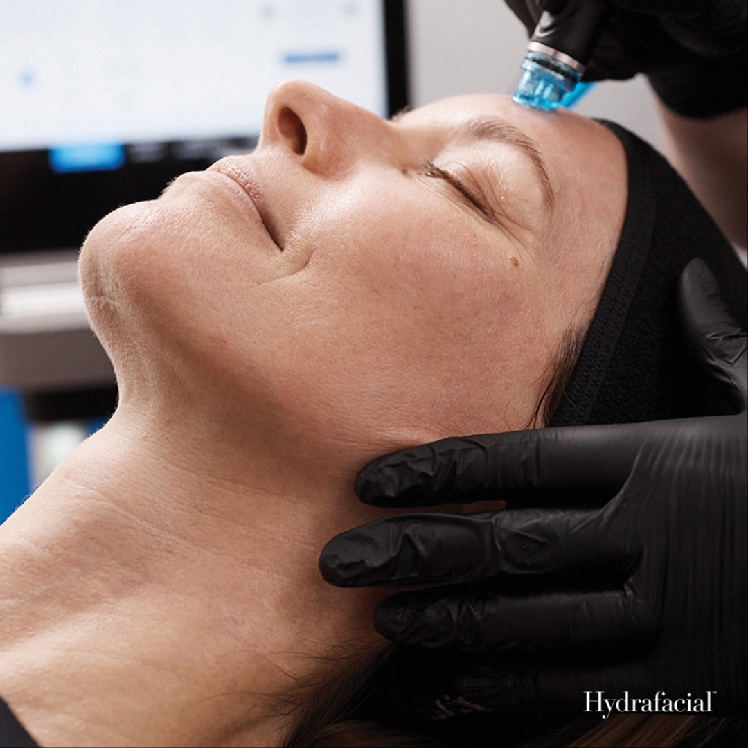 Hydrafacial at AZ Brows & Skin in Scottsdale, AZ
