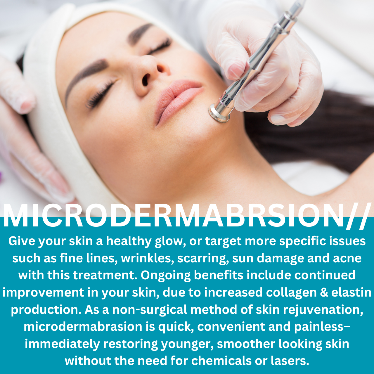 MICRODERMABRASION FACIAL