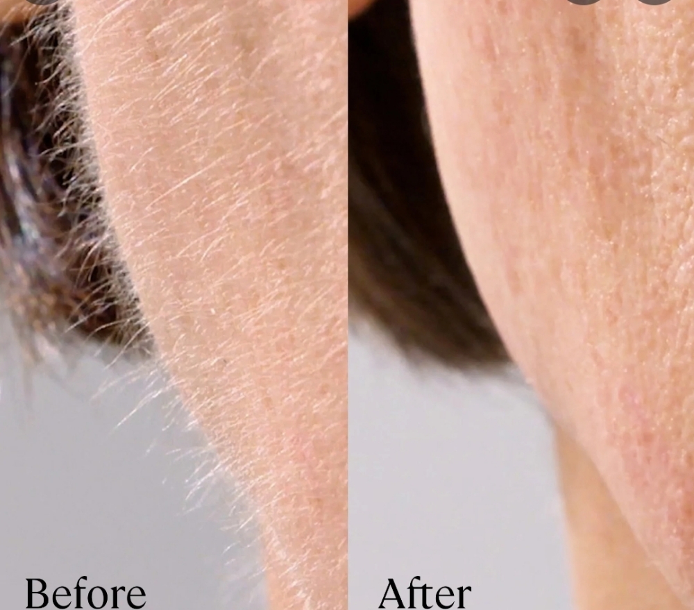 EXPRESS Dermaplaning Treatment