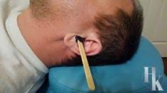 Ear Wax