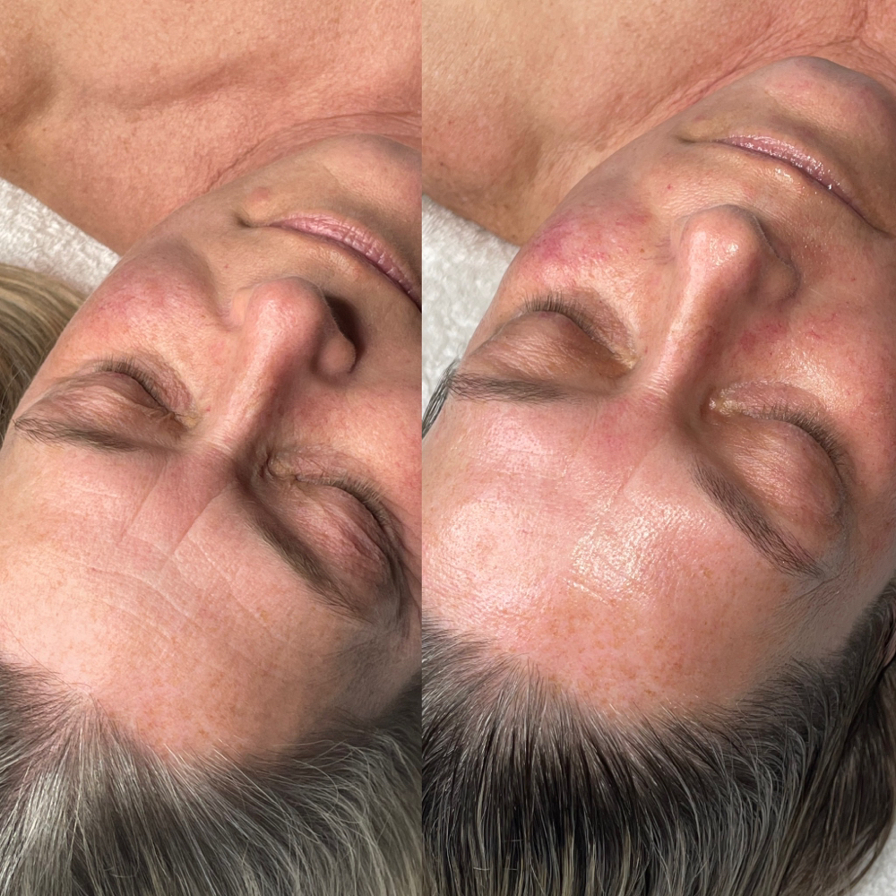 Signature facial