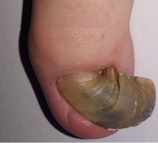 Specialized Pedicure