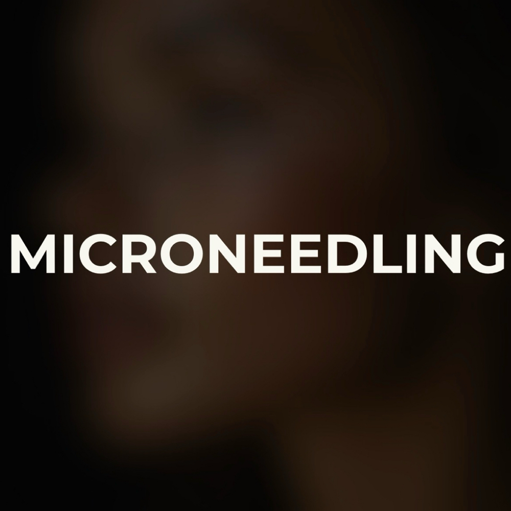 Collagen Induction Therapy (Microne at Turtle Creek Aesthetics in Texas, TX