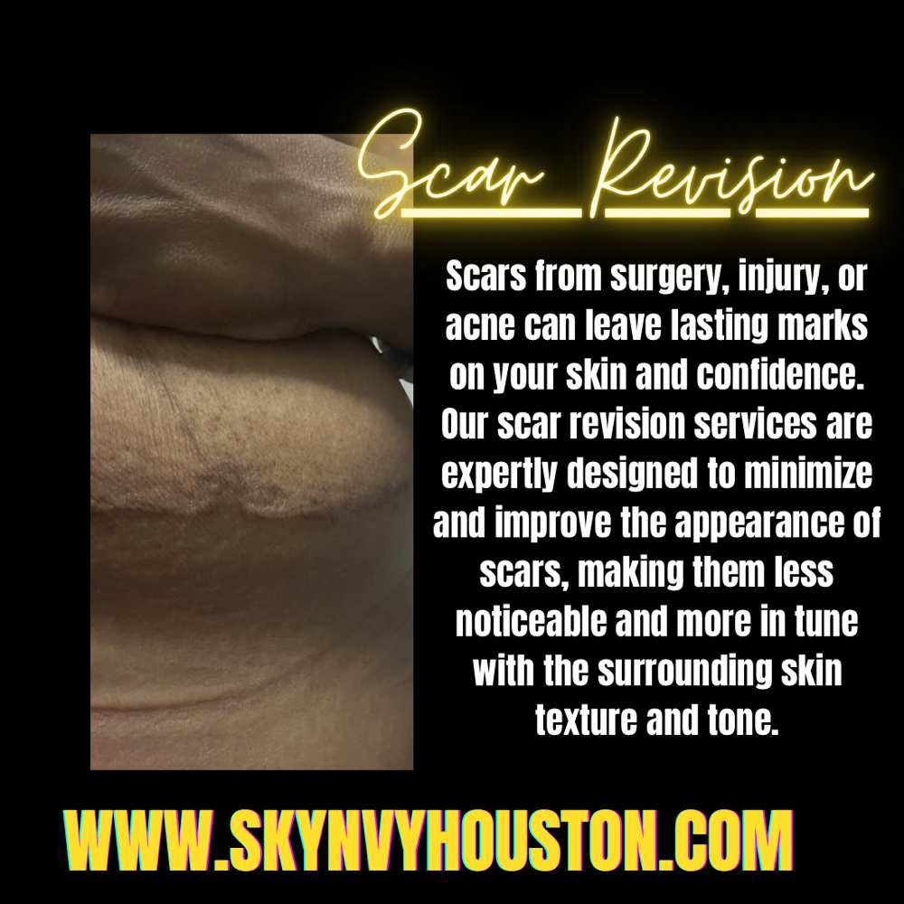 Scar Revision Treatment