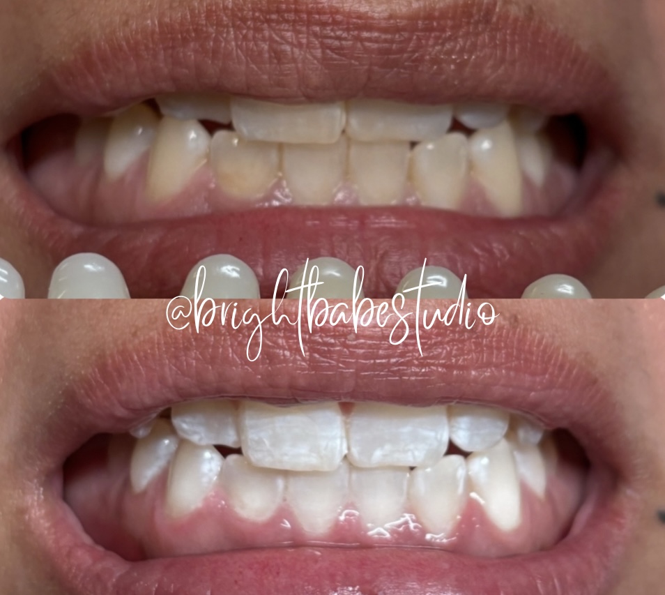 Bright Babe Glow Refresh- 45 Min at Bright Babe Studio in Alice, TX