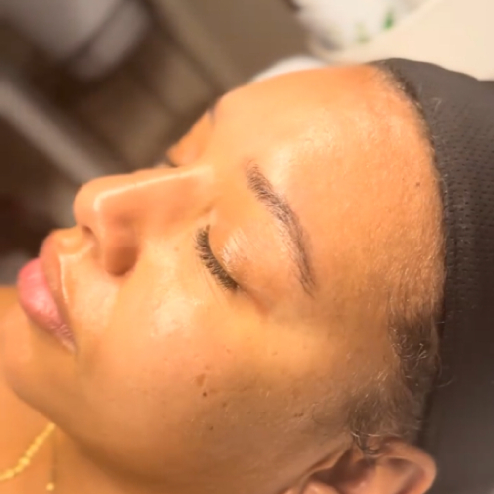 Dermaplane at Skin Academy in New Bedford, MA