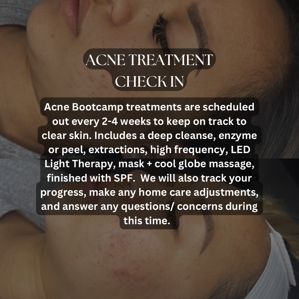 ACNE TREATMENT CHECK IN