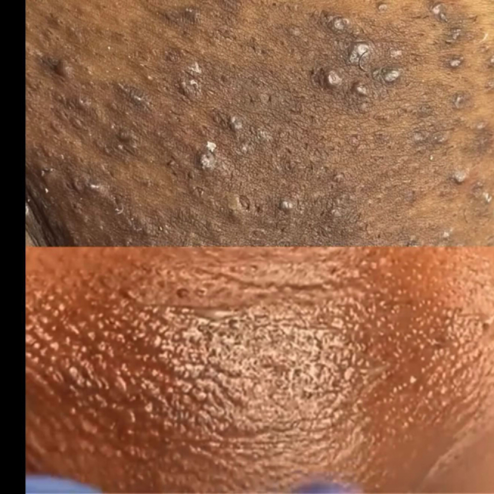 Texture Reset Vajacial at YourTru Beauty in Altamonte Springs, FL