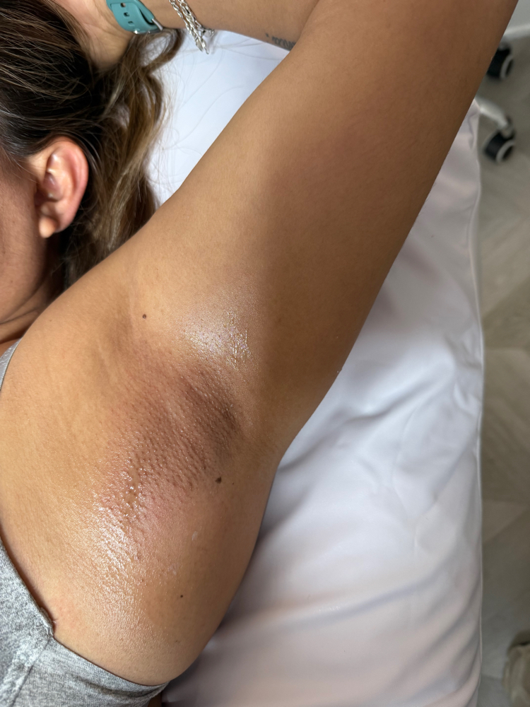 Underarm Wax