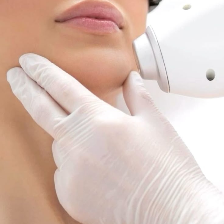 Laser Hair Removal - Chin at Fade + Form Skin Aesthetics in Cartersville, GA