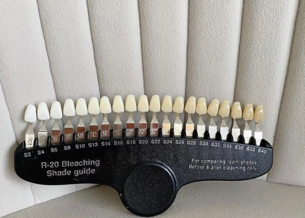 30 minutes Teeth Whitening