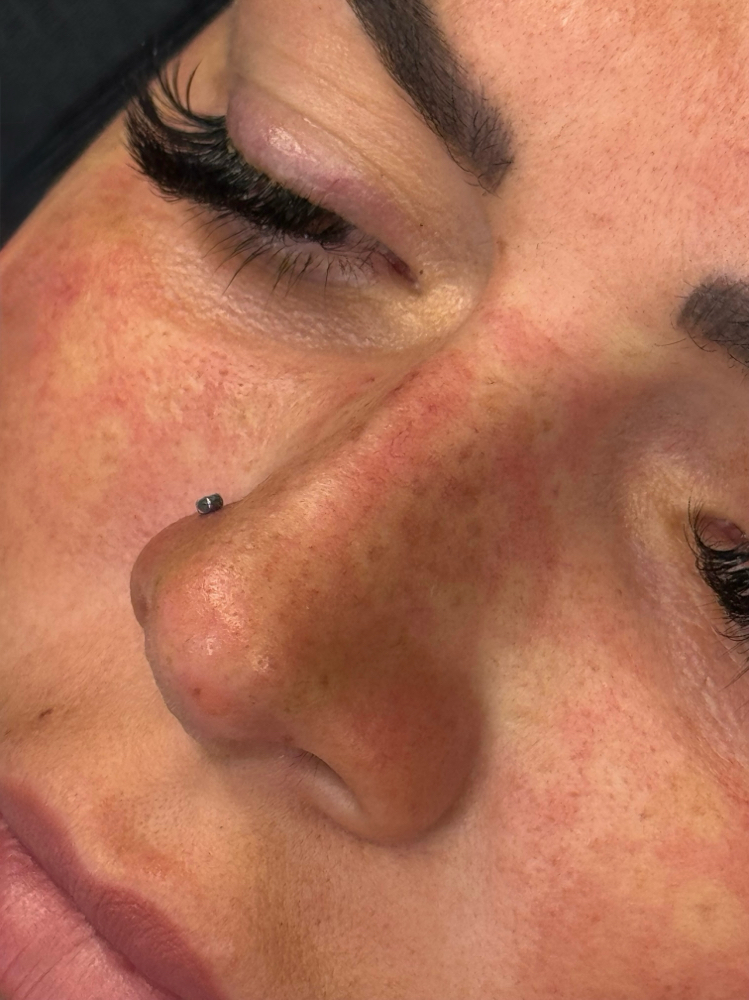 Freckles Low - Medium Coverage