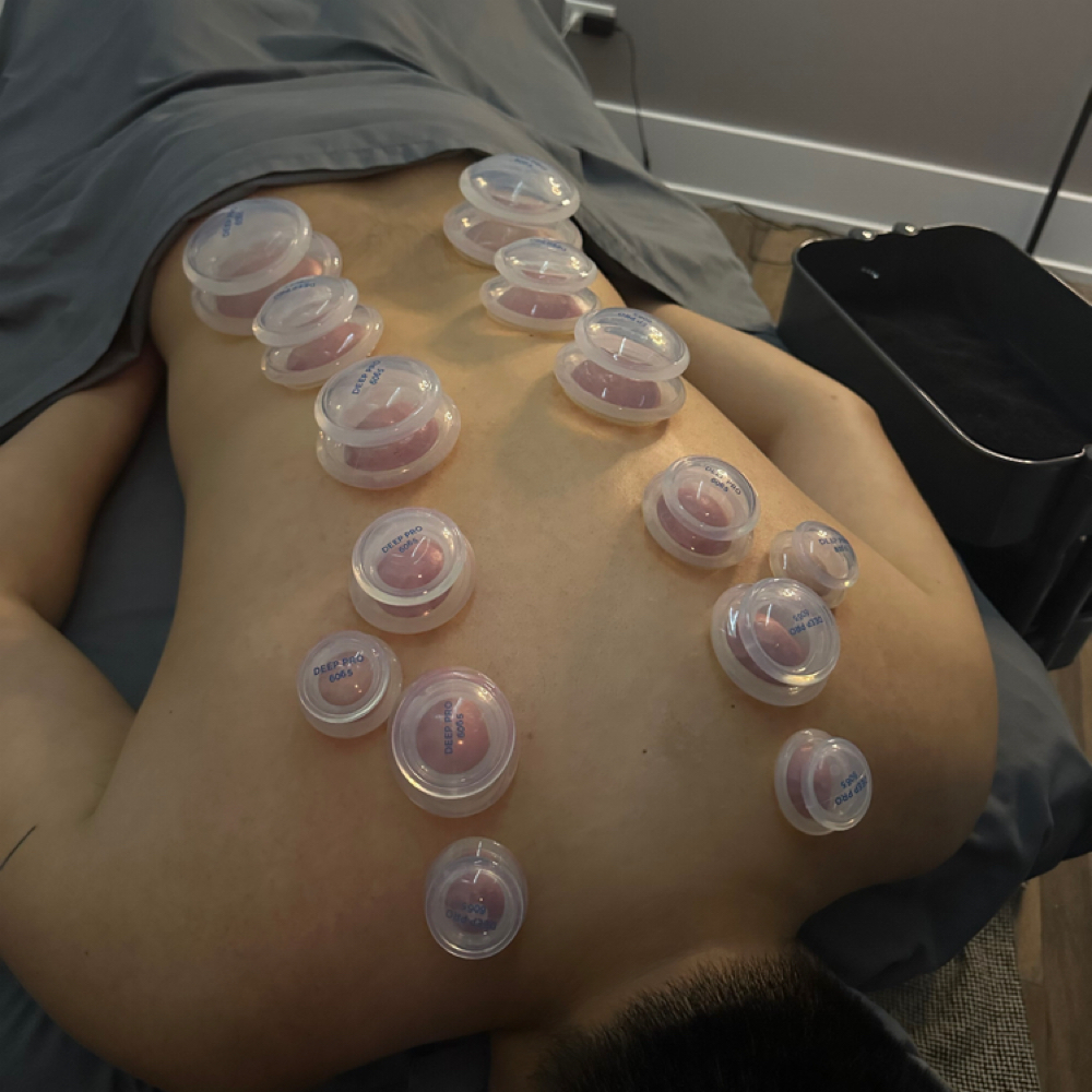 90 Min Custom Massage With Cupping at JJ Hands On Massage Therapy in Schaumburg, IL