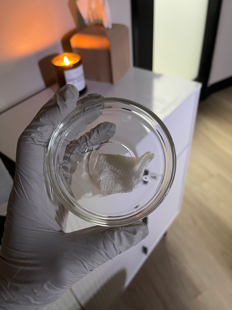 BABY PEEL FACIAL