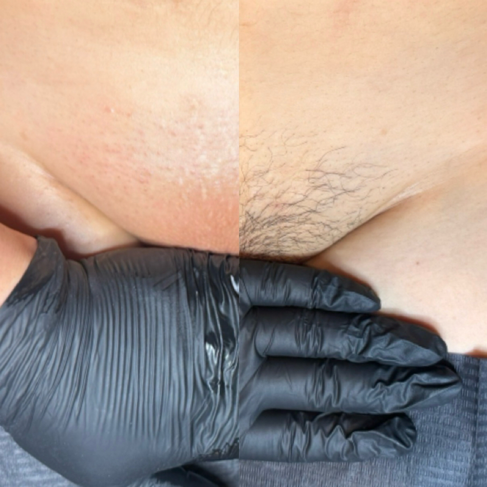 Brazilian Wax Wednesdays(v) at NOBLE BEAUTY in Elk Grove, CA
