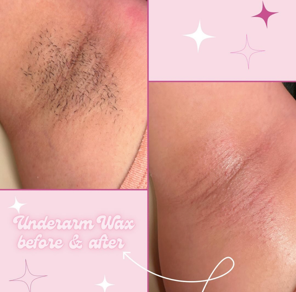 Underarm Waxing