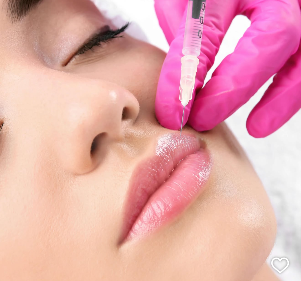 Lip Filler Full Syringe at Glamorous Glowtox By Christina in Pasadena, TX