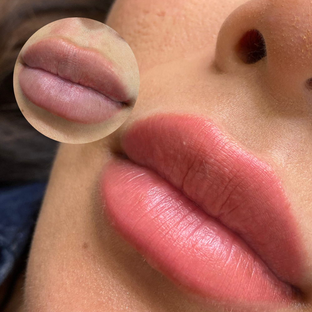 Lip Neutralization
