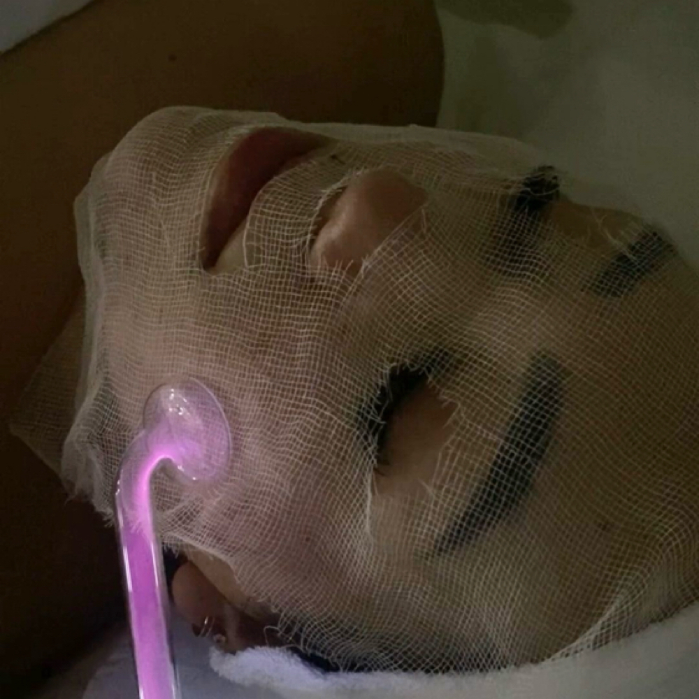 High Frequency at Pearly Derm in Sun valley, CA