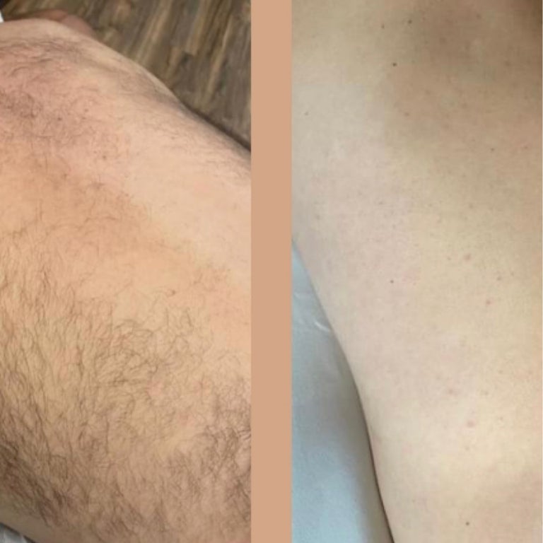 Back Wax