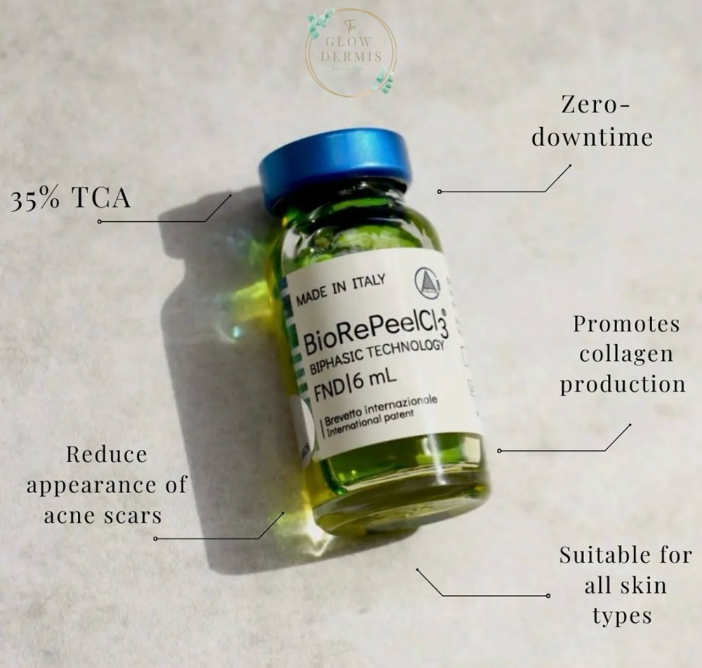 Summer Safe Chemical Peel