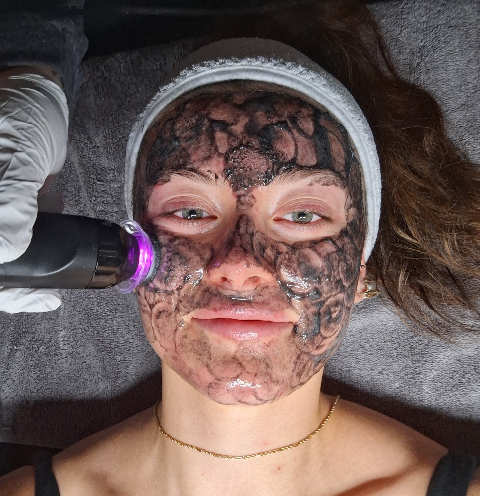 "Luxe" Deluxe Glo2facial