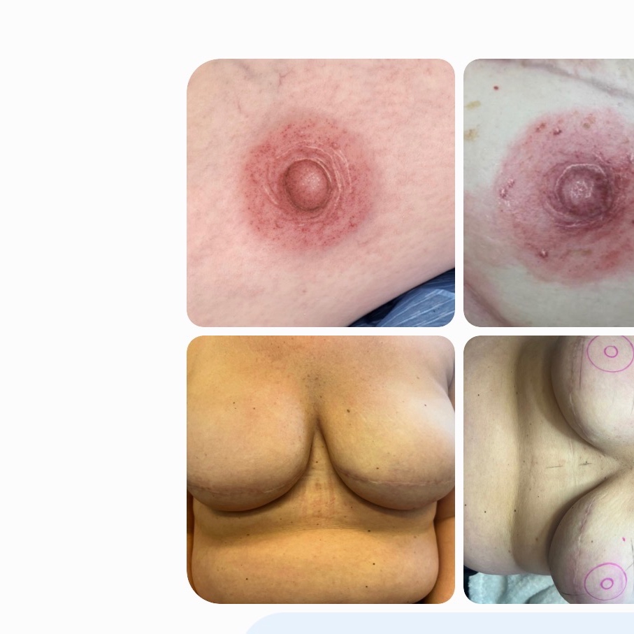 3D Areola - Unilateral at Permanent Cosmetics By Alicia Polk in Bentonville, AR