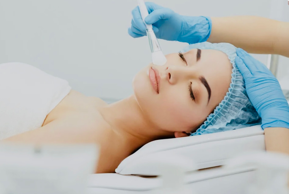 Chemical Peel