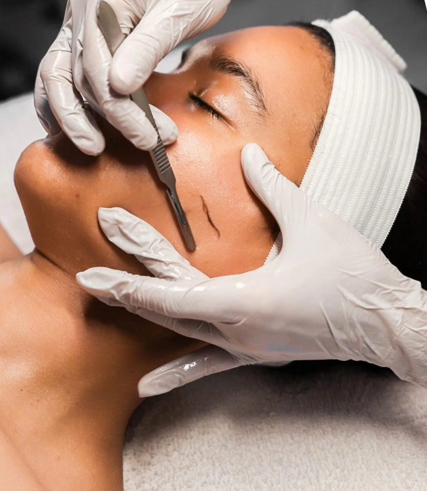 ADD ON: DERMAPLANING