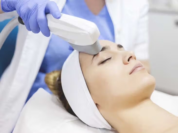 IPL Laser Facial