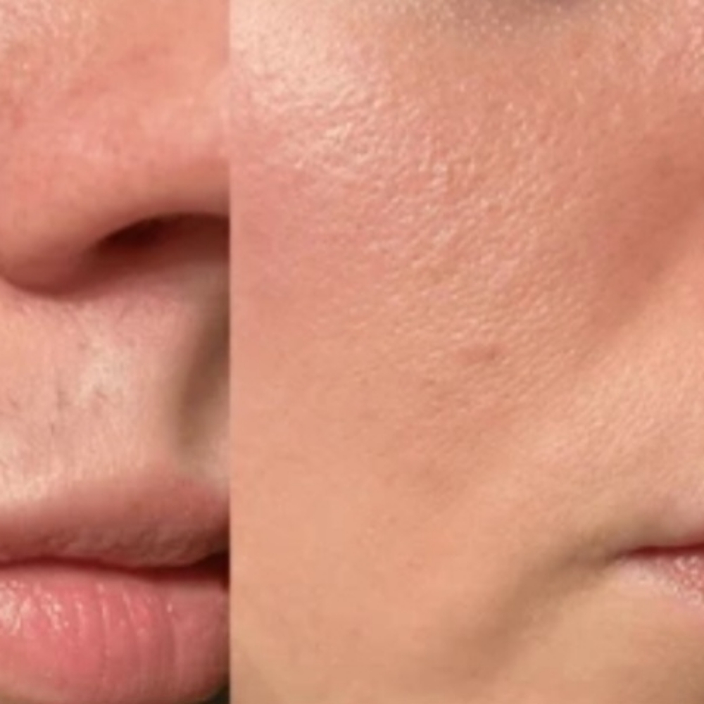 Lips Wax at Lumina Brows and Lahes in Riverside, CA