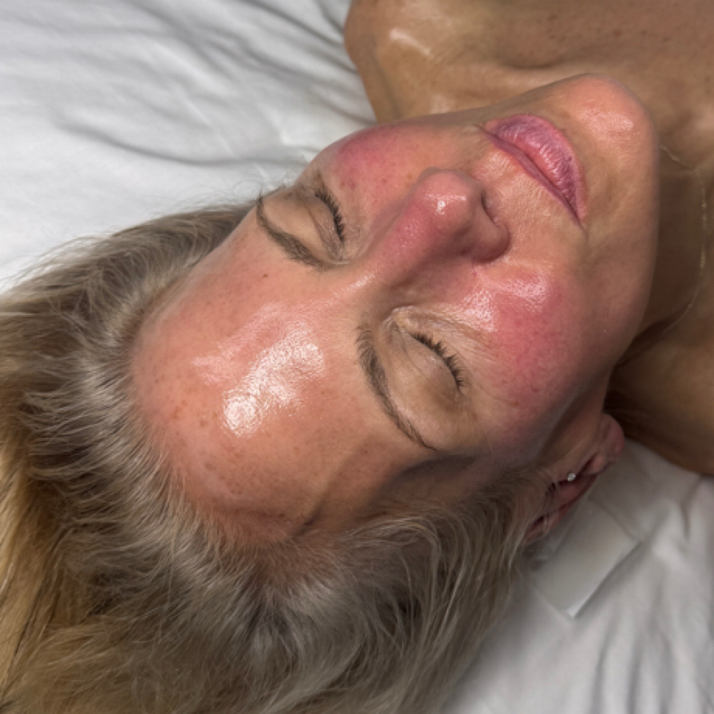 DIAMONDGLOW at The Skin Healer Aesthetics in St. James, NY