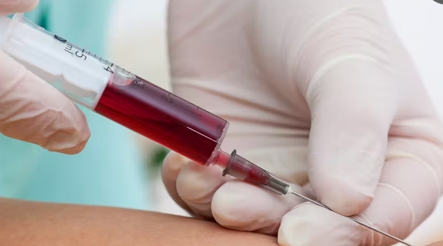 MOMMY 'S BLOOD  TEST GENDER 24 HRS