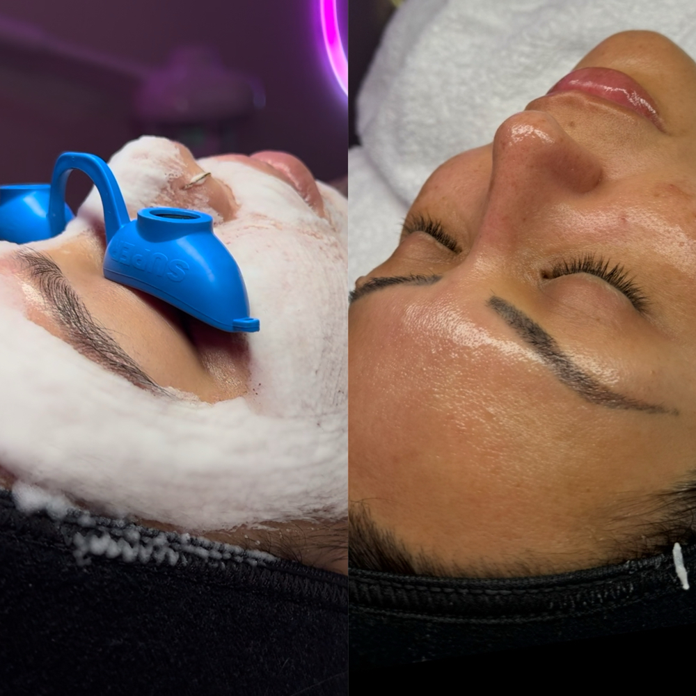 O2 Tighting Protein Lift Facial
