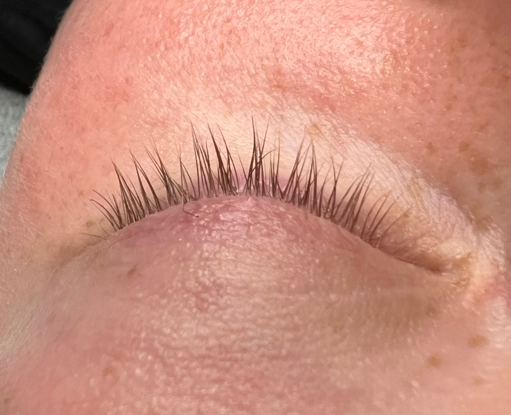 Lash Removal