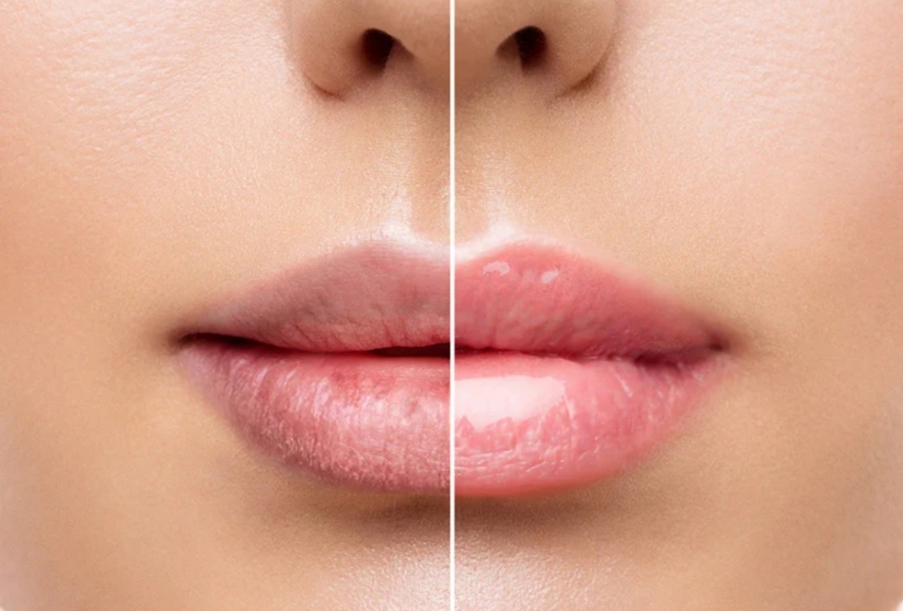 (ADD ON) Lip Scrub