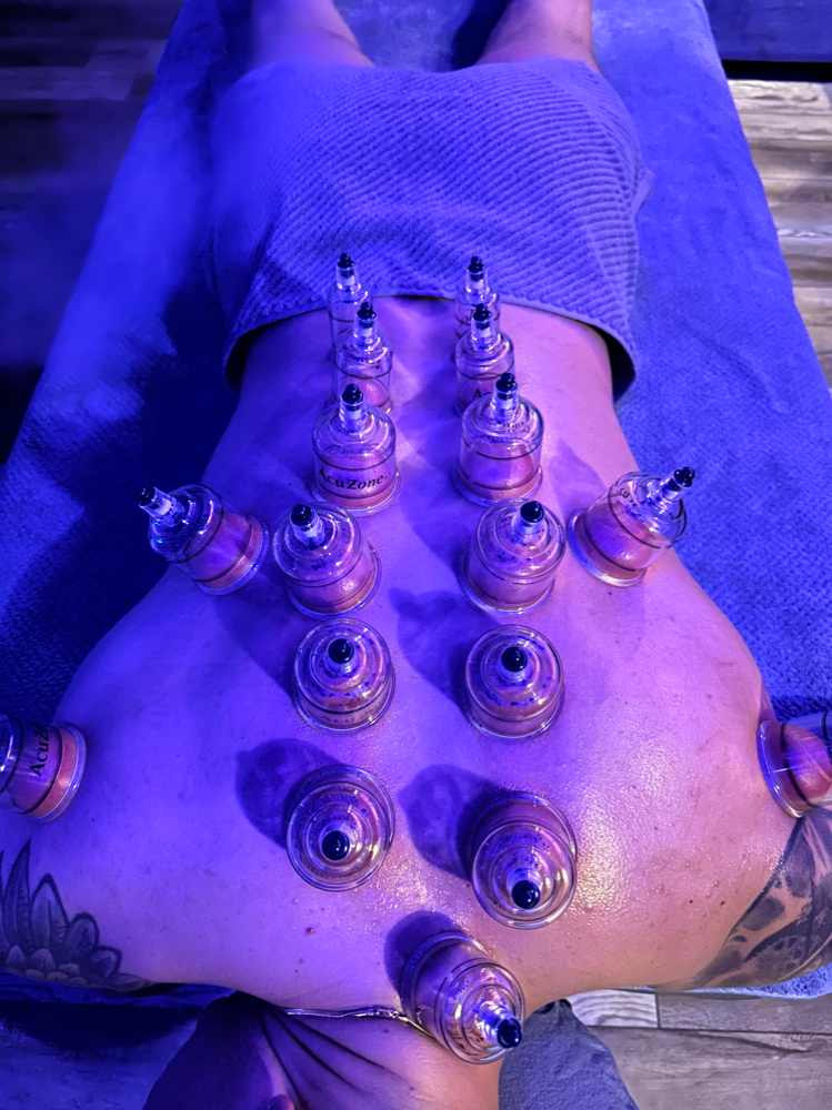 Cupping Massage Therapy - 90 Min