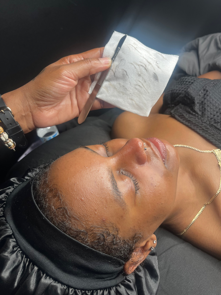 Dermaplaning Facial Treatment