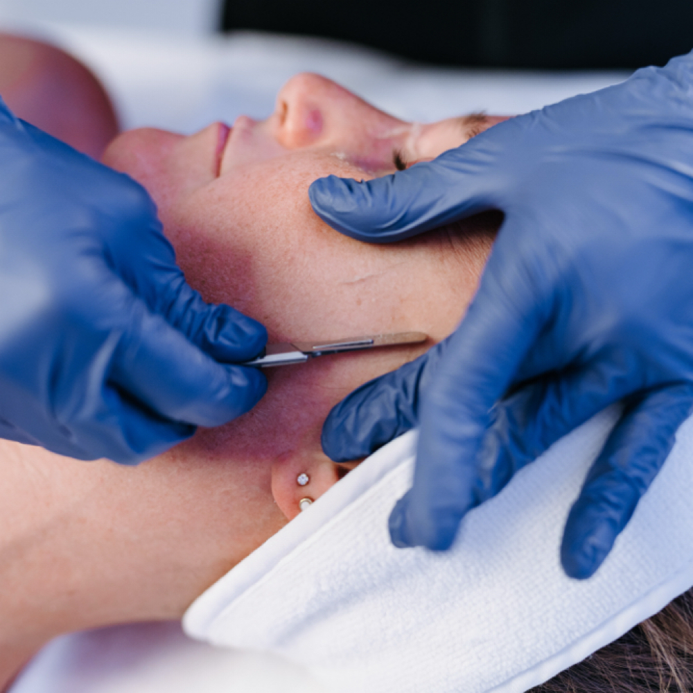 Dermaplaning Facial at Starling Hair & Beauty in Portsmouth, NH