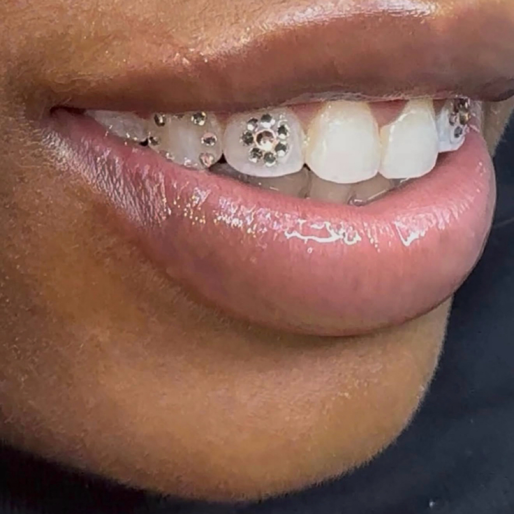 Any Design On 4 Teeth’s at Luxe Glow Smiles in orlando, FL
