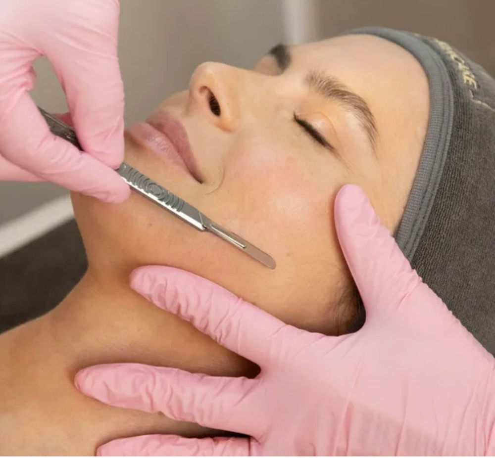 Dermaplaning Treatment