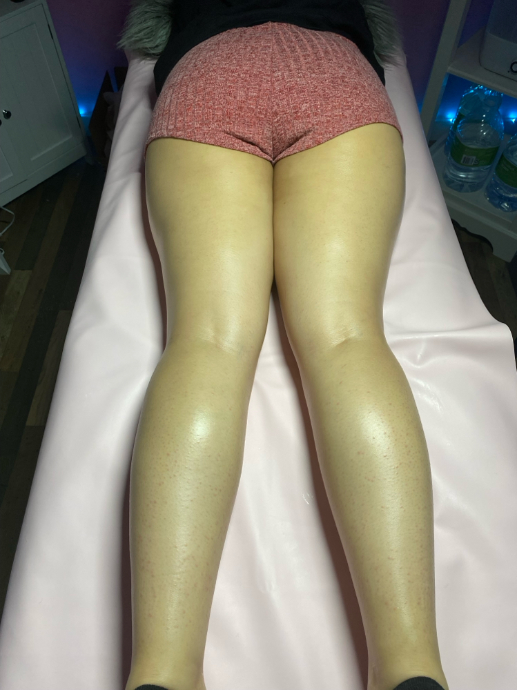 Upper Legs at Bare Beauty Waxing ,LLC in Bridgeport, CT