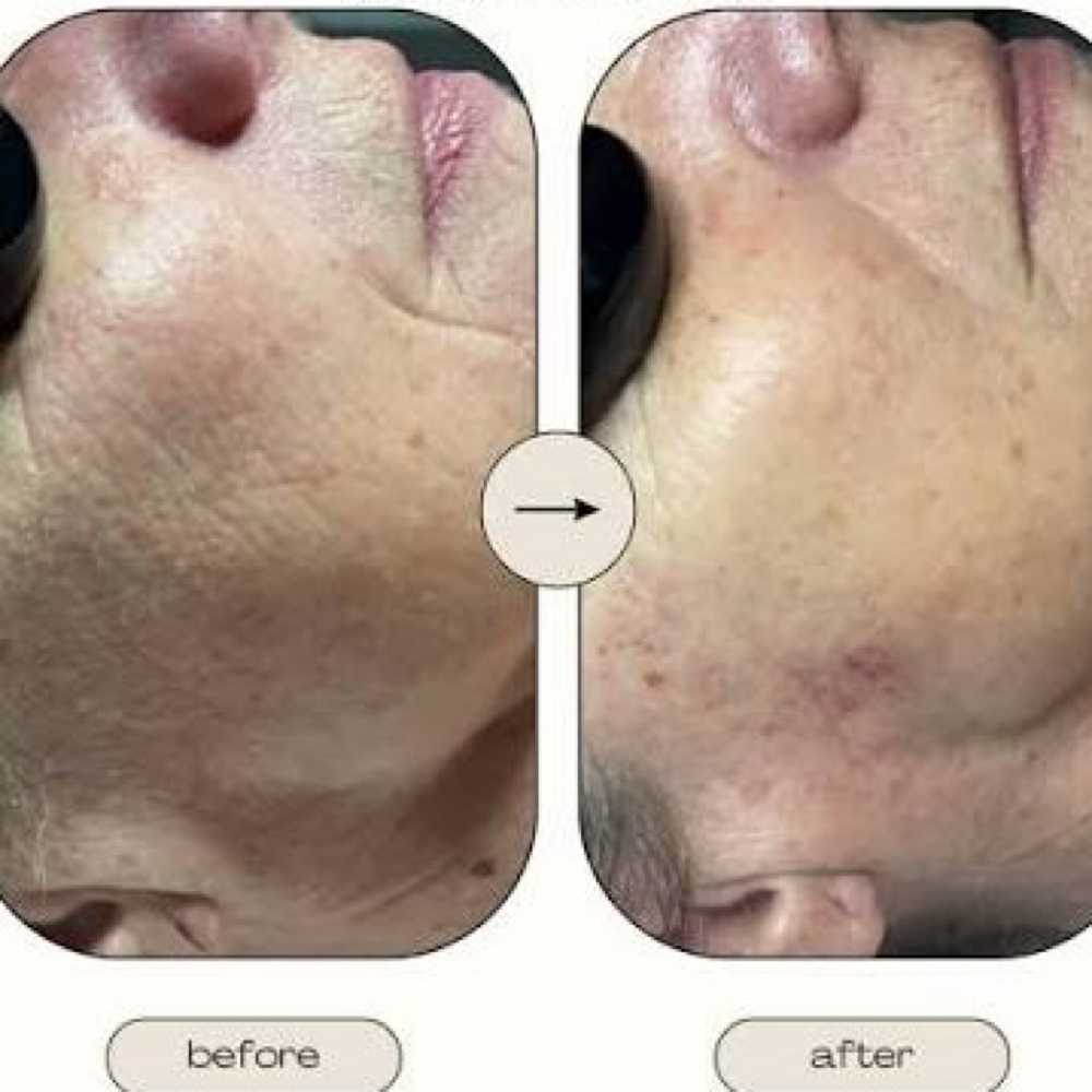 Better Than Botox Peptide Facial at Fresh Face Co. in Shawano, WI
