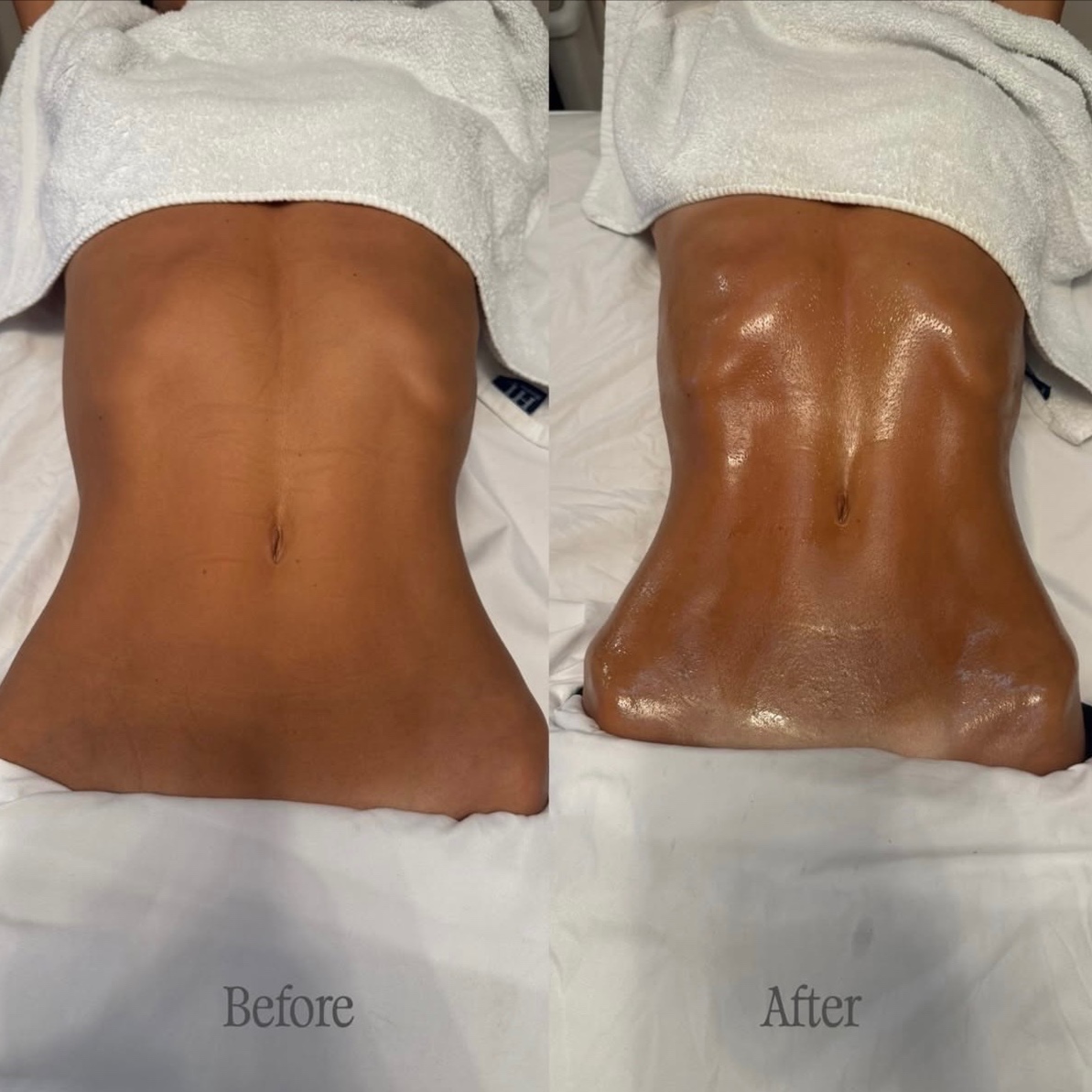 Snatch & Sculpt In-Home Treatment at Skin88 Studio in Beverly Hills, CA