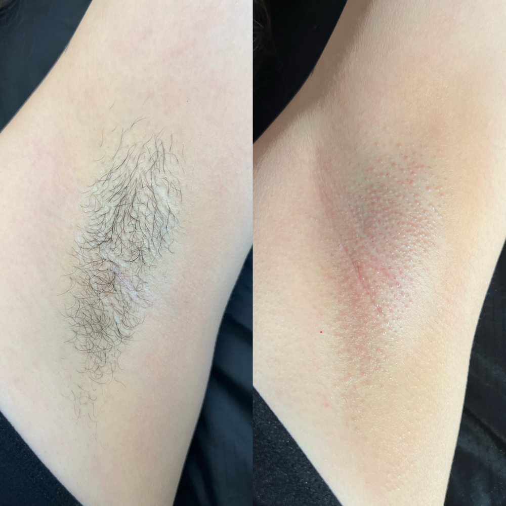Underarm Wax