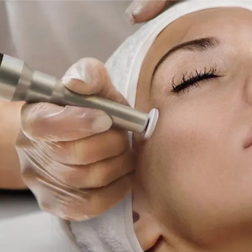 Procell Microchanneling