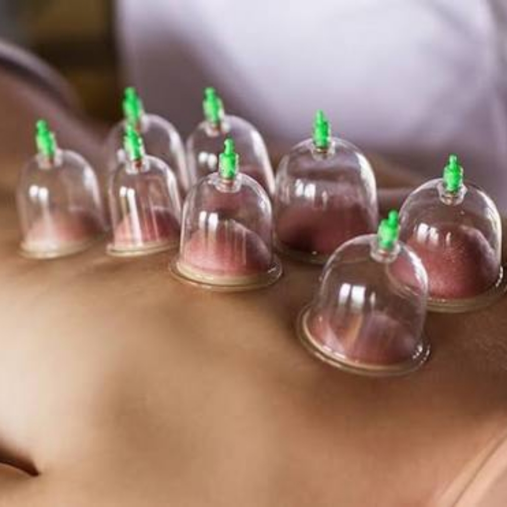 Cupping Massage Therapy at Massage with Alexis M in Bakersfield, CA