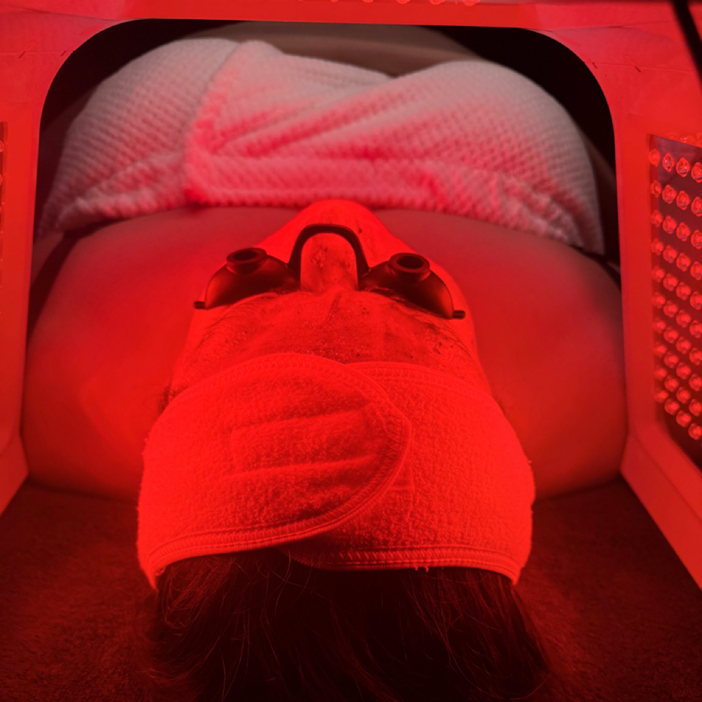 LED for Acne or Hyperpigmentation at Uncommon Esthetics in Rancho Cucamonga, CA