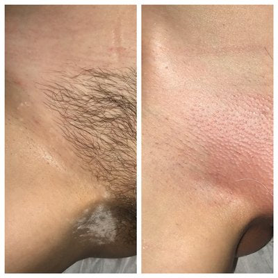 Full Brazilian Wax at Trusted Touch Skin Spa in Ruidoso Downs, NM