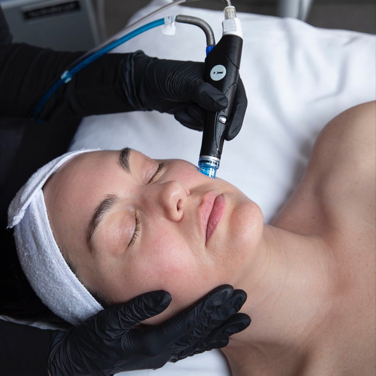 Hydrafacial Deluxe at Illuminate Aesthetics in Greensboro, NC